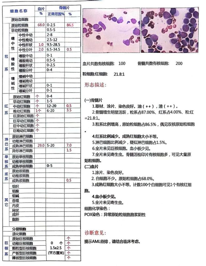 以小见大血尿竟然引出白血病(图2)