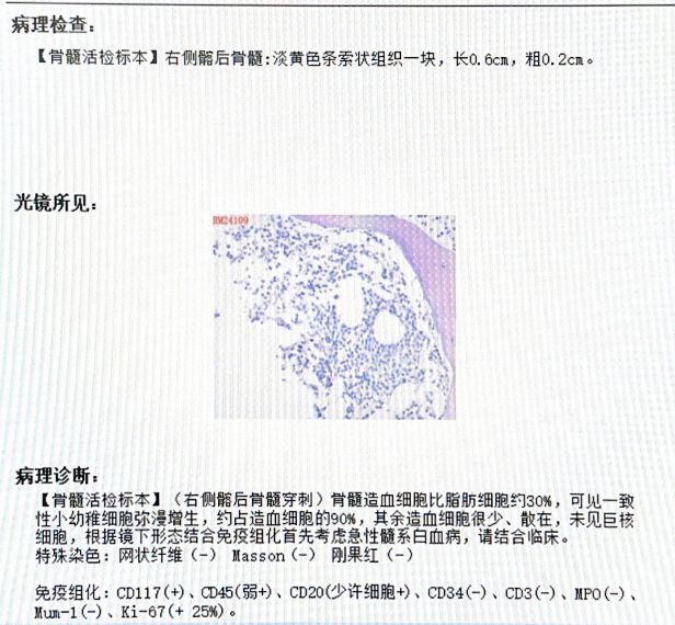 以小见大血尿竟然引出白血病(图3)