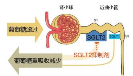 尿糖3+是谁在助力？(图4)