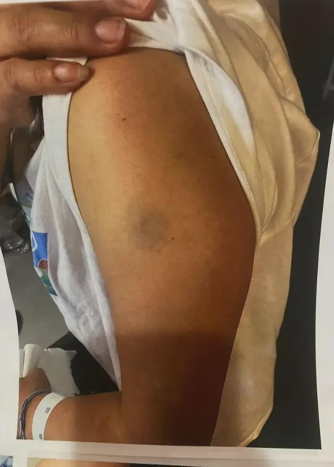 离谱？因为英文沟通问题华人女子本想开安眠药结果竟被送去精神病院…(图1)