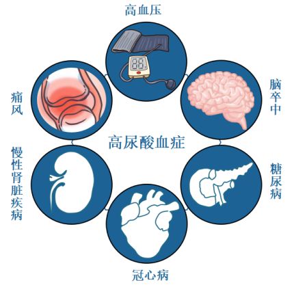 药师说丨一文厘清无症状高尿酸血症是否需要治疗？(图2)