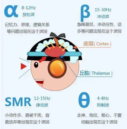 ADHD背后的真相：脑电图异常如何影响智力与认知(图1)